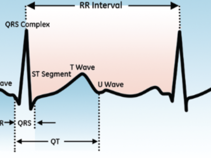 Normal Ecg Rr Interval Range